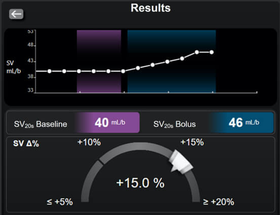 Schermata del test di reattivit&agrave; al fluido